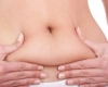 Chirurgia abdomenului sau abdominoplastia