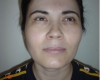 Lifting facial - Caz 1- lifting facial