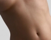 Chirurgia sanilor - Implant mamar